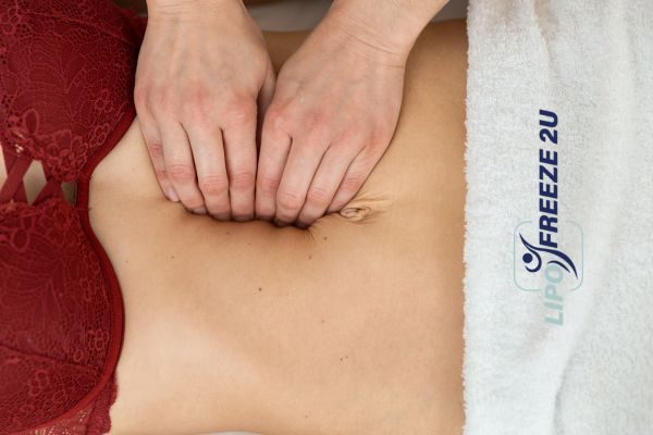 diastasis recti treatment Southend-on-Sea