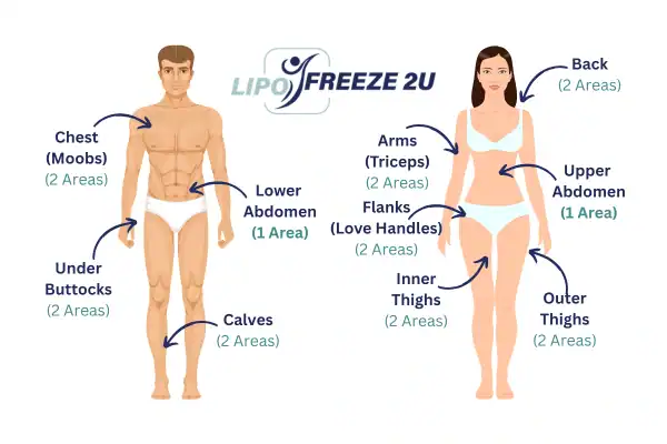 Areas you can have fat freezing treatment Southend-on-Sea