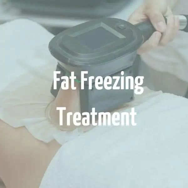 fat freezing treatment Southend-on-Sea