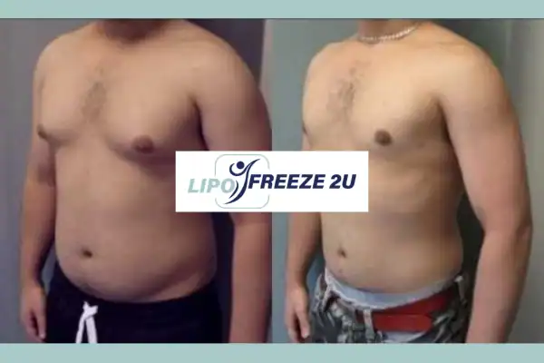 How Long Does It Take to See Results Southend-on-Sea?