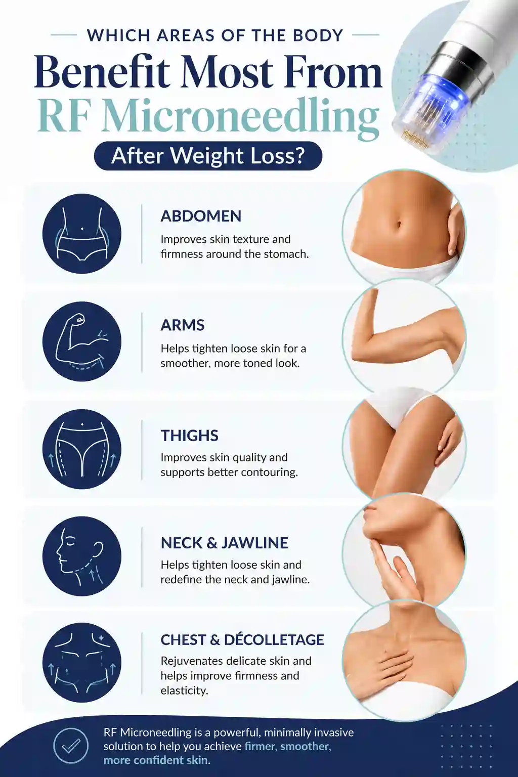 Which Areas of the Body Benefit Most From RF Microneedling After Weight Loss Southend-on-Sea